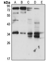 RABGGTB antibody