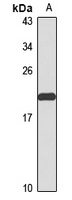RAP1B antibody