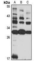Anti-Dexras1 Antibody