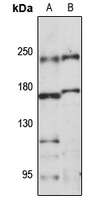 Anti-RB1CC1 Antibody