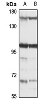 Anti-RBM10 Antibody