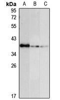 Anti-RBM11 Antibody