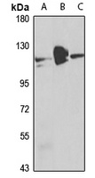 Anti-RBM15 Antibody
