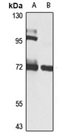 RBM15B antibody