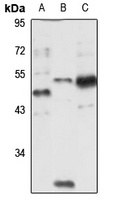 Anti-RBM4 Antibody