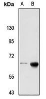 Anti-RBM46 Antibody