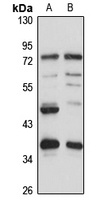 RBM4B antibody