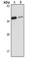 RBM7 antibody