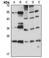 RBM8A antibody