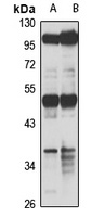 RBMS1 antibody
