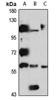 RCBTB2 antibody