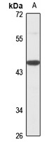 Anti-RCCD1 Antibody