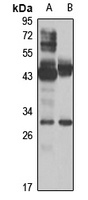 Anti-Pirh2 Antibody