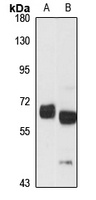 Anti-CoREST Antibody