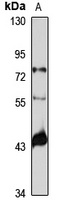 Anti-RENBP Antibody