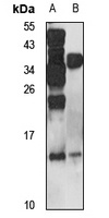 Anti-RELM beta Antibody