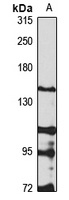 Anti-REV1 Antibody