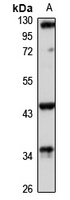 Anti-RGMA Antibody