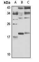 RGS8 antibody