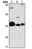 RHBDD1 antibody