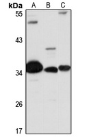 Anti-RHBDD1 Antibody