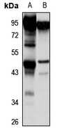 RHBDL1 antibody