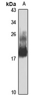 Anti-RhoB Antibody