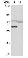 Anti-RHOBTB1 Antibody