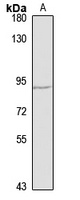 Anti-RIPK4 Antibody
