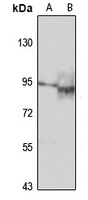 Anti-RIPK4 Antibody