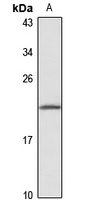 Anti-RNase H2C Antibody