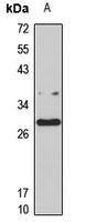 RNF138 antibody