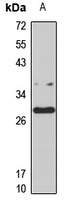 Anti-RNF138 Antibody