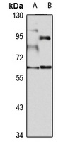 Anti-RNF168 Antibody