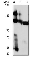 Anti-RNF20 Antibody