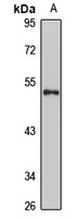 Anti-RNMTL1 Antibody