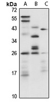 Anti-RPE Antibody