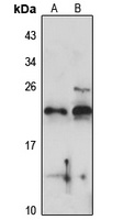 Anti-RPL24 Antibody
