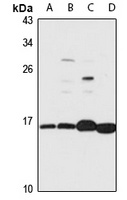 Anti-RPL31 Antibody