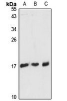 Anti-RPL36AL Antibody