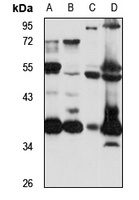 RPRD1A antibody