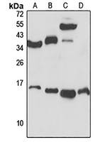 Anti-RPS25 Antibody