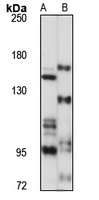 Anti-RAPTOR Antibody