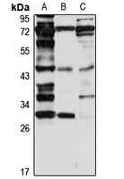 Anti-RPUSD4 Antibody