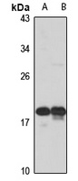 RSL24D1 antibody