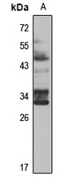 Anti-RSPO1 Antibody