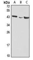 RSPO3 antibody