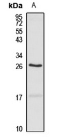 RTN3 antibody