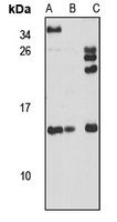 Anti-SAA4 Antibody