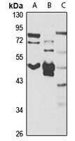 Anti-SAP30BP Antibody